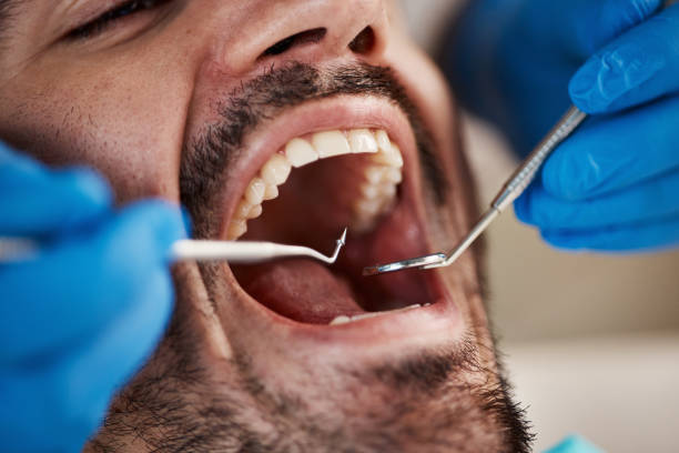 Best Urgent Tooth Repair  in Cooper City, FL