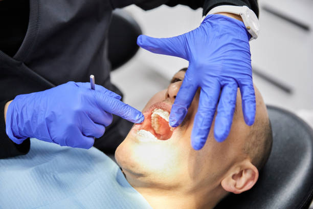 Best Chipped Tooth Repair Near Me  in Cooper City, FL